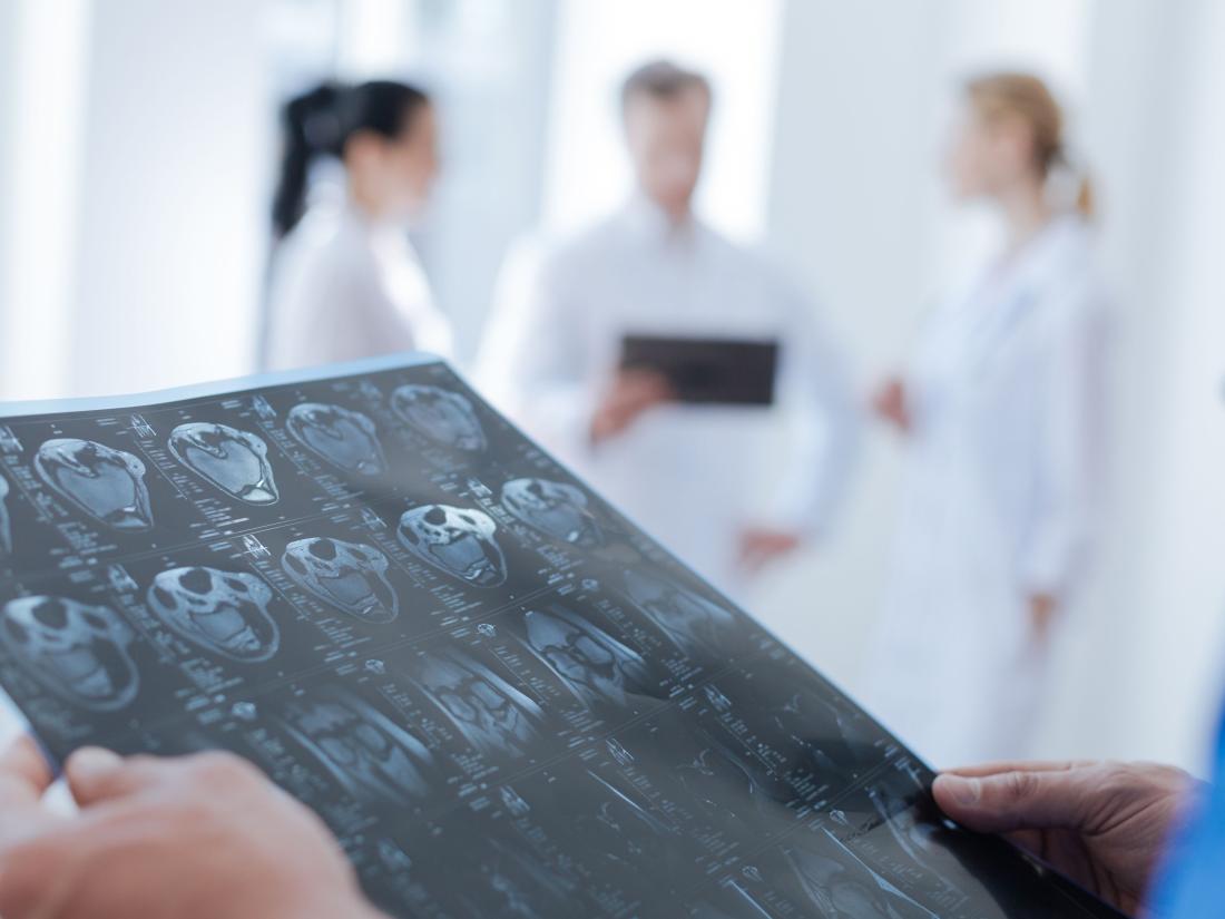 X-ray sheet being revised in clinic.